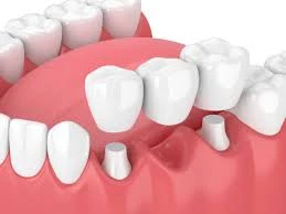 Oral