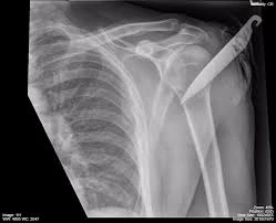 X-ray opacifiers & diagnostic reagents